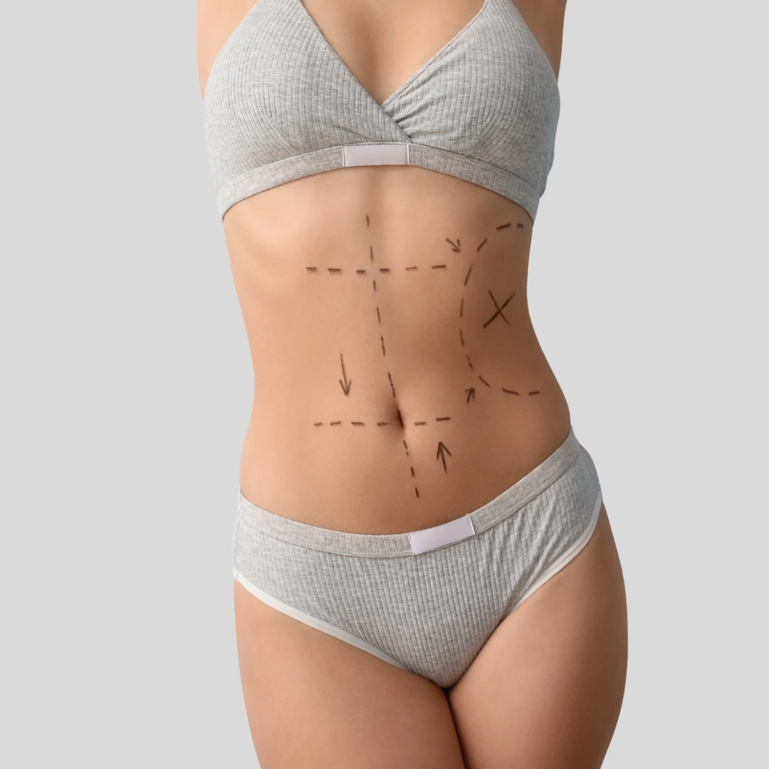 Abdominoplasty / Tummy Tuck